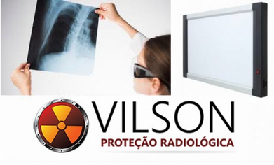 Equipamento Negatoscópio Radiografia Franco da Rocha - Negatoscópio de Radiologia