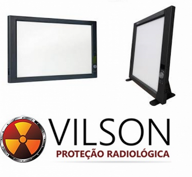 Onde Comprar Negatoscópio de Mesa Caparaó - Negatoscópio Radiografia