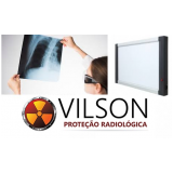 equipamento negatoscópio radiografia Redenção